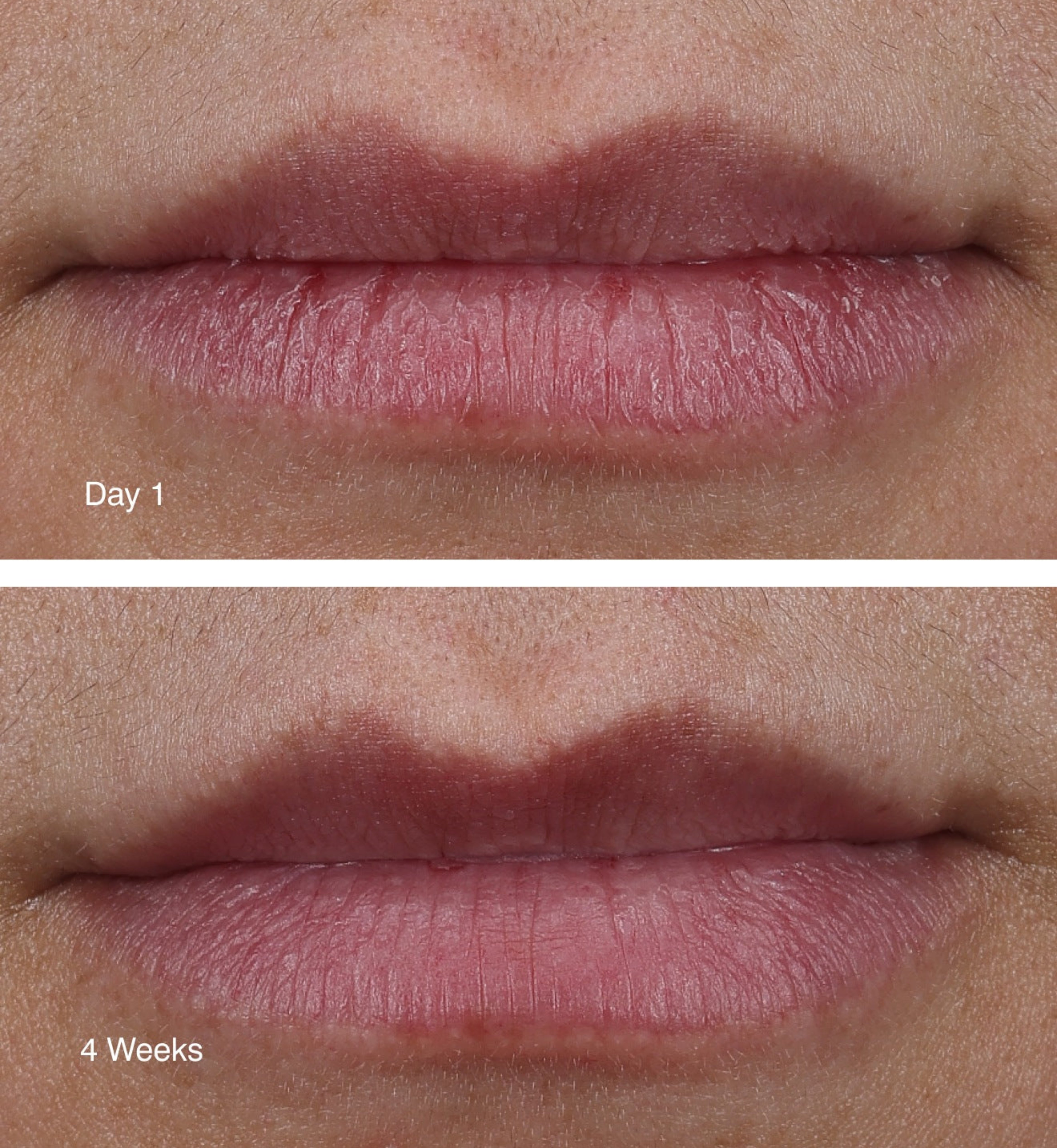 Rhode peptide lip treatment 'unscented'